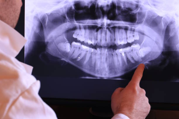 Best Pediatric Emergency Dentist in Deerwood, TX
